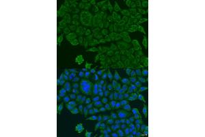 Immunofluorescence analysis of U2OS cells using BCS1L antibody (ABIN2736351) at dilution of 1:100. (BCS1L antibody)