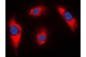 Immunofluorescent analysis of MRPS18C staining in K562 cells. (MRPS18C antibody)