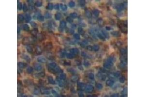 Figure. (LY9 antibody  (AA 2-212))