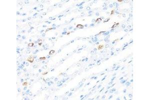 Immunohistochemistry of paraffin-embedded Mouse kidney using FGF10 Polyclonal Antibody at dilution of 1:100 (40x lens). (FGF10 antibody)