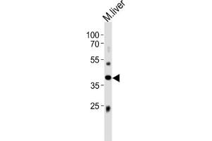 Western Blotting (WB) image for anti-ABI Family, Member 3 (ABI3) antibody (ABIN3004709) (ABI3 antibody)
