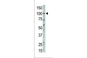 The anti-MVP C-term Antibody (ABIN390156 and ABIN2840655) is used in Western blot to detect MVP in  lysate. (MVP antibody  (C-Term))