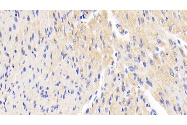 HbA1c antibody