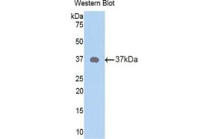 Detection of Recombinant NPY, Rat using Polyclonal Antibody to Neuropeptide Y (NPY) (NPY antibody  (AA 31-98))