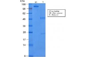 SDS-PAGE Analysis Purified Cytokeratin 8 Mouse Recombinant Monoclonal Antibody (rB22. (Recombinant KRT8 antibody)