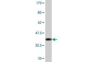 Western Blot detection against Immunogen (36. (IdnK antibody  (AA 41-141))