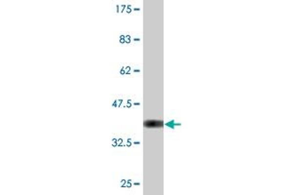 IdnK Antikörper  (AA 41-141)