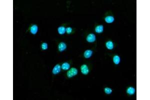 IF analysis of CENPB using anti-CENPB antibody (ABIN7602867).