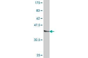 Western Blot detection against Immunogen (37. (ABCC8 antibody  (AA 611-710))