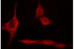ABIN6274715 staining HepG2 cells by IF/ICC. (PSMD12 antibody  (Internal Region))
