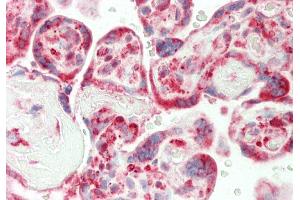 Rabbit Anti-CRIP1 antibody  Formalin Fixed Paraffin Embedded Tissue: Human Placenta Primary antibody Concentration: 1:100 Secondary Antibody: Donkey anti-Rabbit-Cy3 Secondary Antibody Concentration: 1:200 Magnification: 20x Exposure Time: 0. (CRIP1 antibody  (N-Term))