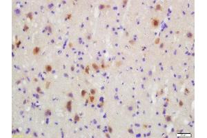 Formalin-fixed and paraffin embedded rat brain labeled with Rabbit Anti-MKK3(Ser218)/MKK6(Ser207) Polyclonal Antibody, Unconjugated  at 1:200 followed by conjugation to the secondary antibody and DAB staining (MAP2K3 antibody  (pSer207))