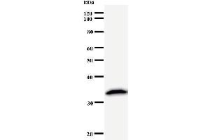 Western Blotting (WB) image for anti-PRP8 Pre-mRNA Processing Factor 8 (PRPF8) antibody (ABIN933118)