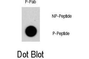 Image no. 1 for anti-Nuclear Receptor Subfamily 4, Group A, Member 1 (NR4A1) (pSer351) antibody (ABIN358306) (NR4A1 antibody  (pSer351))