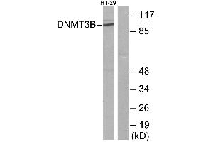 Immunohistochemistry analysis of paraffin-embedded human liver carcinoma tissue using DNMT3B antibody. (DNMT3B antibody)