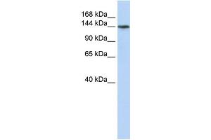 WB Suggested Anti-ATP11B Antibody Titration:  0. (ATP11B antibody  (N-Term))