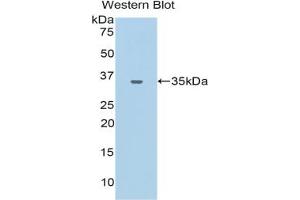 Western blot analysis of the recombinant protein. (CEACAM1 antibody  (AA 35-320))