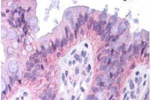 Human Colon: Formalin-Fixed, Paraffin-Embedded (FFPE) (CEBPA antibody  (AA 288-337))