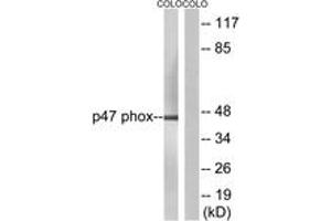 Western blot analysis of extracts from COLO205, using p47 phox (Ab-304) Antibody.