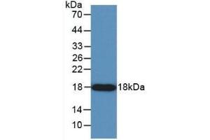 Detection of Recombinant ANG, Human using Monoclonal Antibody to Angiogenin (ANG) (ANG antibody  (AA 25-147))