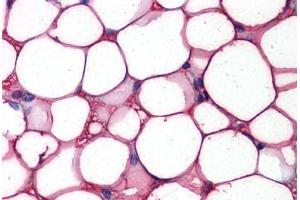 Adipocytes, Human: Formalin-Fixed, Paraffin-Embedded (FFPE) (FABP4 antibody  (Tyr20))