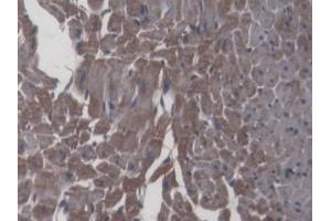 Detection of IL6 in Rat Cardiac Muscle Tissue using Monoclonal Antibody to Interleukin 6 (IL6) (IL-6 antibody  (AA 25-211))