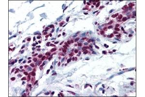 Human Breast: Formalin-Fixed, Paraffin-Embedded (FFPE) (MYB antibody  (N-Term))