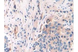 Immunohistochemistry (IHC) image for anti-Interferon, gamma-Inducible Protein 30 (IFI30) (AA 1-250) antibody (ABIN7435856)