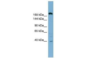 ABCC11 antibody used at 1 ug/ml to detect target protein. (ABCC11 antibody)