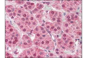 Human Adrenal (formalin-fixed, paraffin-embedded) stained with PARP2at 2. (PARP2 antibody  (Internal Region))