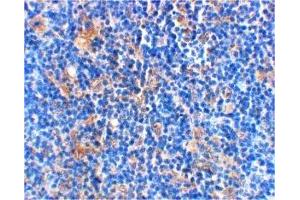 Immunohistochemistry (IHC) image for anti-BCL2-Associated Agonist of Cell Death (BAD) (C-Term) antibody (ABIN1030278) (BAD antibody  (C-Term))