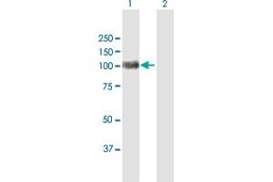 Western Blot analysis of ACO1 expression in transfected 293T cell line by ACO1 MaxPab polyclonal antibody. (Aconitase 1 antibody  (AA 1-889))