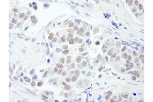 Immunohistochemistry (IHC) image for anti-GATA Binding Protein 3 (GATA3) (AA 150-200) antibody (ABIN7454559) (GATA3 antibody  (AA 150-200))