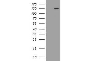 Image no. 1 for anti-Fibroblast Growth Factor Receptor 3 (FGFR3) (AA 23-375) antibody (ABIN1491237) (FGFR3 antibody  (AA 23-375))