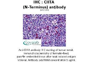 Image no. 1 for anti-Class II, Major Histocompatibility Complex, Transactivator (CIITA) (N-Term) antibody (ABIN1733098) (CIITA antibody  (N-Term))