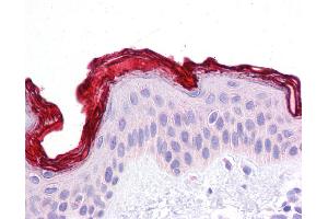 DBT antibody was used for immunohistochemistry at a concentration of 4-8 ug/ml. (DBT antibody  (N-Term))