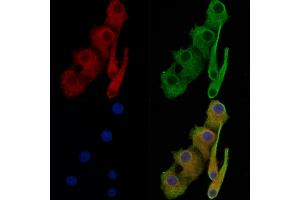 ABIN7093772 and ABIN7097813 staining Hela cells by IF/ICC. (beta Catenin antibody)