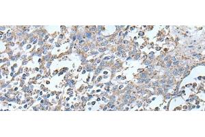 Immunohistochemistry of paraffin-embedded Human tonsil tissue using IRF5 Polyclonal Antibody at dilution of 1:25(x200) (IRF5 antibody)