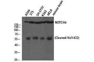 Western Blotting (WB) image for anti-Notch 4 (NOTCH4) (cleaved), (Val1432) antibody (ABIN3172780) (NOTCH4 antibody  (cleaved, Val1432))