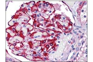 Human Kidney: Formalin-Fixed, Paraffin-Embedded (FFPE) (FREM2 antibody)