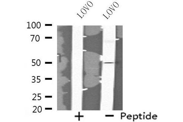 FOXN4 antibody  (C-Term)