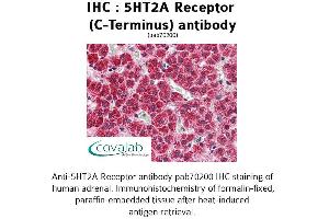 Image no. 1 for anti-5-Hydroxytryptamine (serotonin) Receptor 2A (HTR2A) (C-Term) antibody (ABIN1731361) (HTR2A antibody  (C-Term))