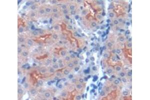 Figure. (SPTLC2 antibody  (AA 453-560))