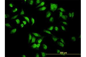 Immunofluorescence (IF) image for anti-Eukaryotic Translation Initiation Factor 2-alpha Kinase 2 (EIF2AK2) (AA 1-100) antibody (ABIN562440)