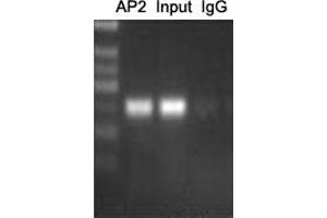 ChIP analysis of Cervical cancer cell lines lysate, incubated for 12 hours at 4°C. (AP2 alpha/beta (C-Term) antibody)