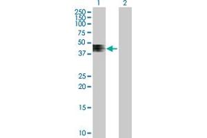 Western Blot analysis of ZNRF4 expression in transfected 293T cell line by ZNRF4 MaxPab polyclonal antibody. (ZNRF4 antibody  (AA 1-429))