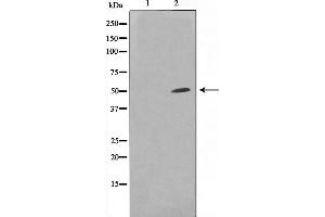 Western blot analysis on HuvEc cell lysate using SUPT3H Antibody,The lane on the left is treated with the antigen-specific peptide. (SUPT3H/SPT3 antibody  (Internal Region))
