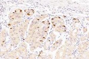 Immunohistochemistry analysis of paraffin-embedded human stomach using,Epsin-3 (ABIN7073856) at dilution of 1: 4400 (EPN3 antibody)