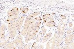 Immunohistochemistry analysis of paraffin-embedded human stomach using,Epsin-3 (ABIN7073856) at dilution of 1: 4400
