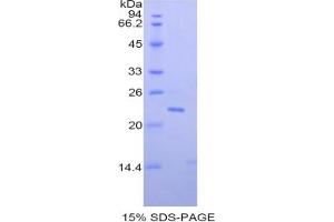 SDS-PAGE of Protein Standard from the Kit (Highly purified E. (PON1 ELISA Kit)